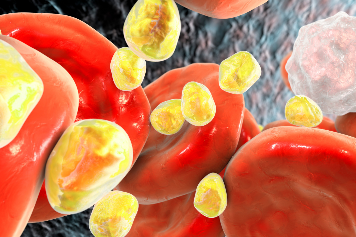Xét nghiệm mỡ máu đánh giá cholesterol và triglyceride để hỗ trợ theo dõi nguy cơ tim mạch
