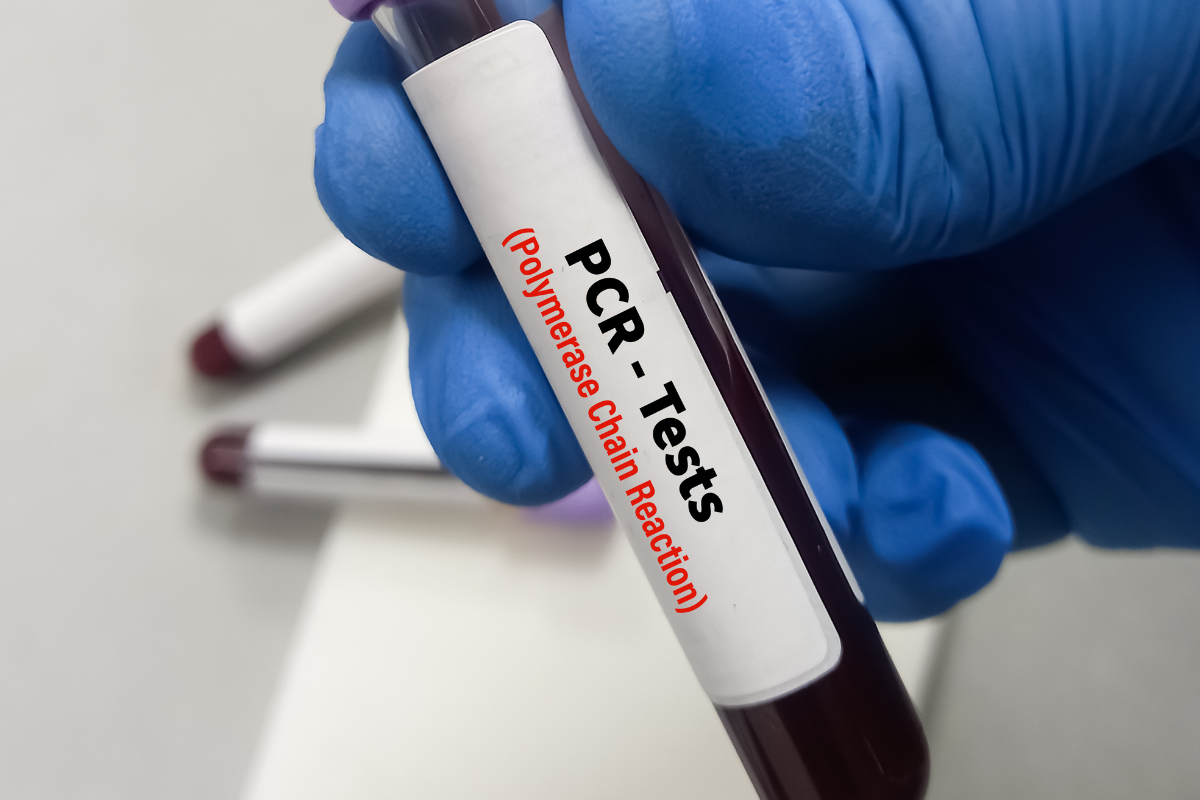 Xét nghiệm PCR được ứng dụng rộng rãi trong phát hiện tác nhân gây bệnh